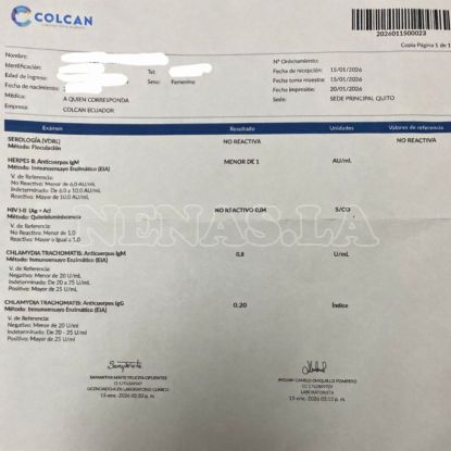 Isa, foto #6, 0983464800, Quito, Ecuador